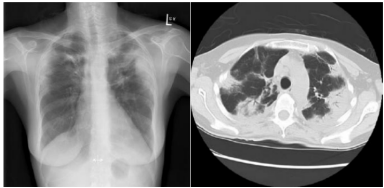 /uploads/image/2022/09/26/1c4fc8e8c64fec7da990e7f7396d19ee.png image.png