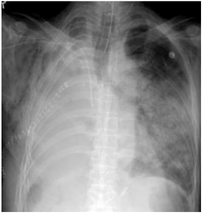 /uploads/image/2022/09/26/255cf259f645ce47587cda40792d0313.png image.png